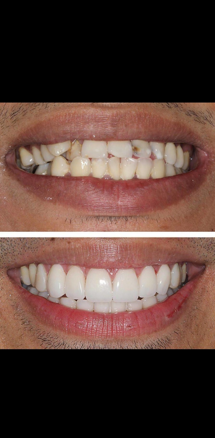 Before treatment