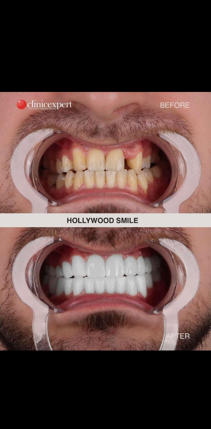 After treatment